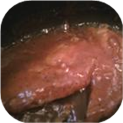 Honey Chicken